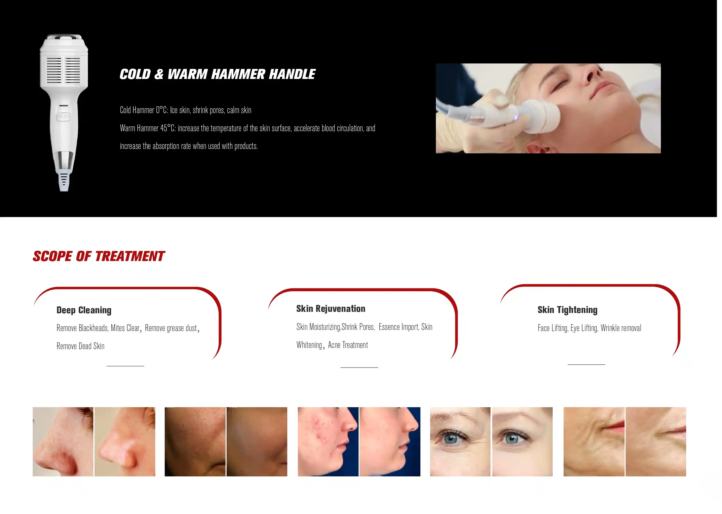 Hydra Facial Machine Manufacturers in Bangalore Hydra Facial Machine Manufacturers in Bangalore