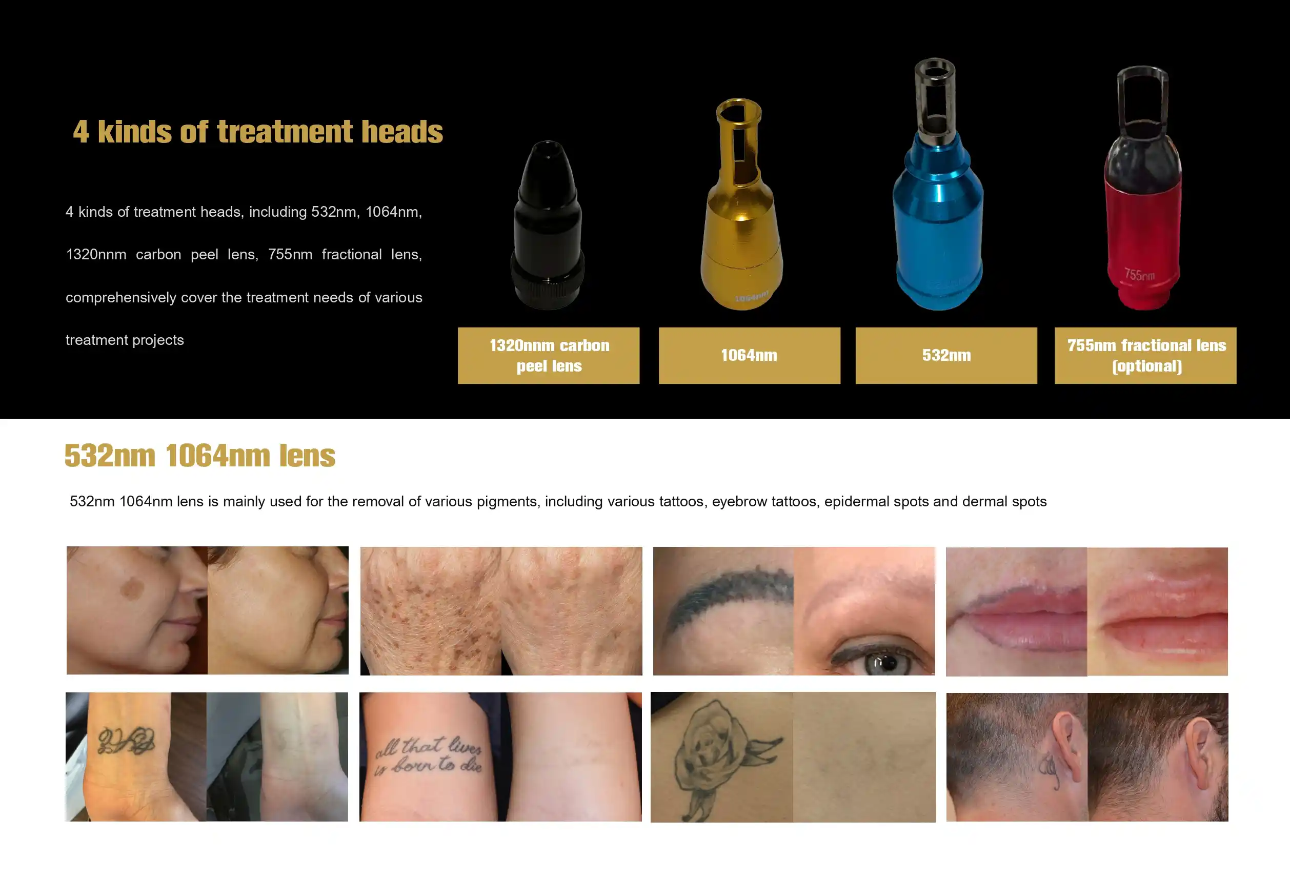 Nd Yag Laser Manufacturers Nd Yag Laser Manufacturers